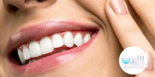 How to maintain white teeth after using a whitening kit?