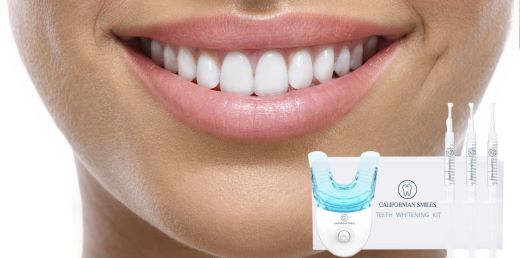 What is the best teeth whitening kit?